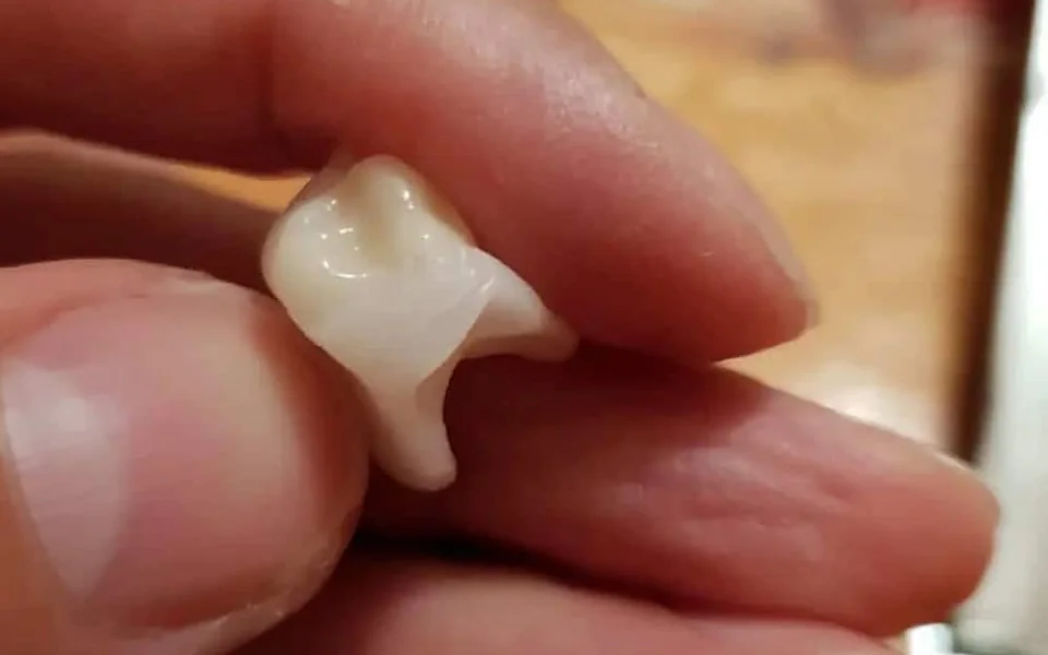 Skutočný zub Denticor so zubným mostíkom DentiFlex medzi prstami