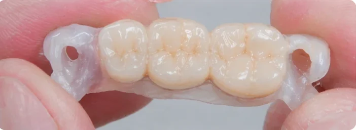Tri zuby Denticor v jednom dieli