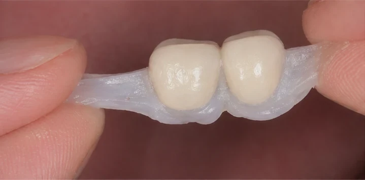 Pružný zubný mostík DentiFlex natiahnutý medzi prstami