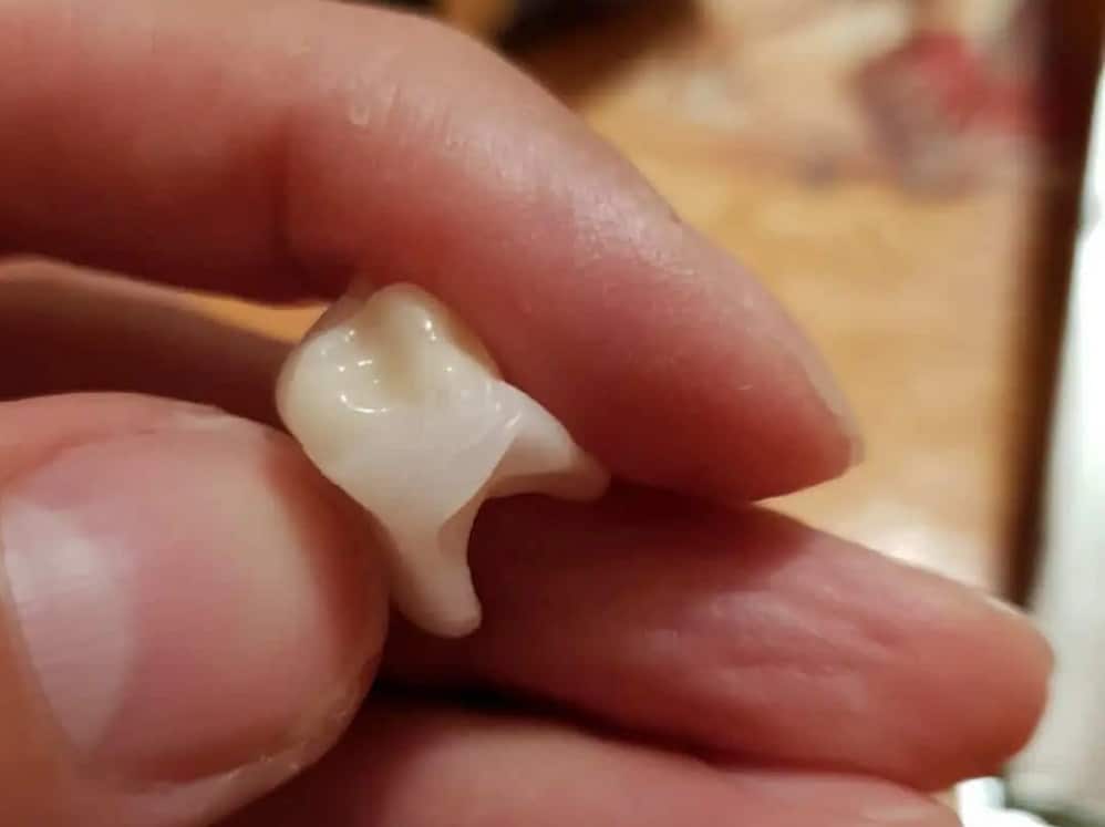 Detail korunky a tvarovania materiálu Denticor
