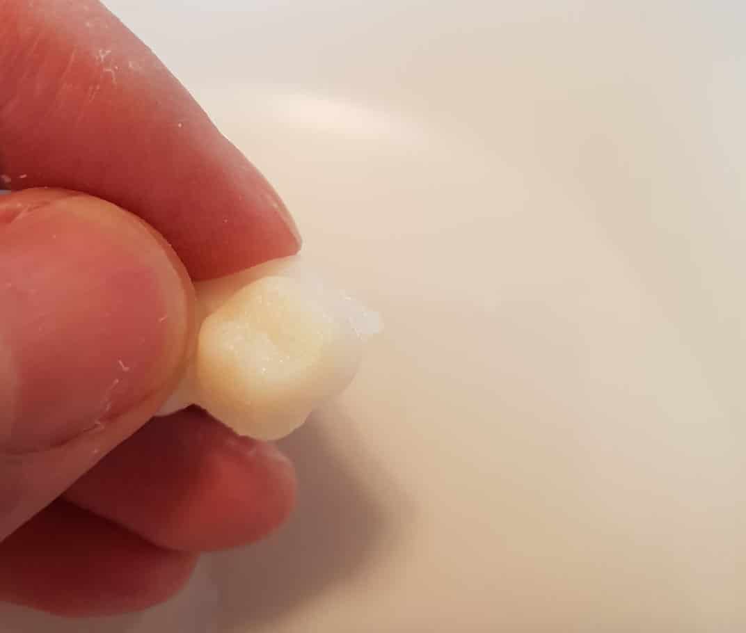 Prvý prototyp zubnej náhrady Denticor