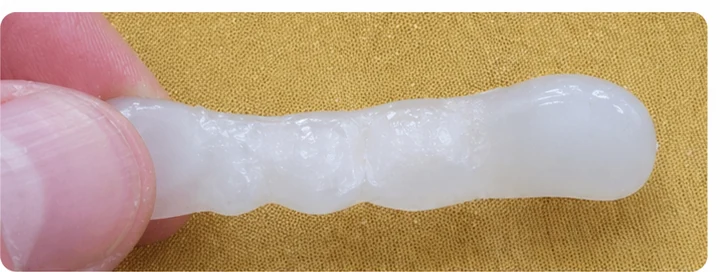 Vizuálny postup pre očný zub a dva premoláre hore – princíp vloženia Denticor mostíka s novými zubami a jeho dotvarovania o okolité zuby
