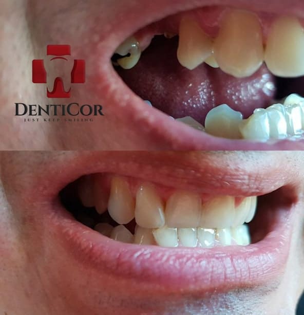 Zákazník — pred a po z troch uhlov