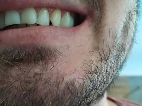 Zákazník A — po nasadení Denticoru