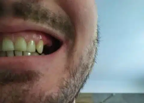 Zákazník A — pred nasadením Denticoru