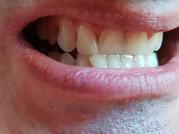 Zákazník B — po nasadení Denticoru