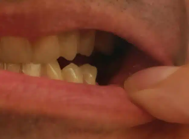 Zákazník C — pred nasadením Denticoru