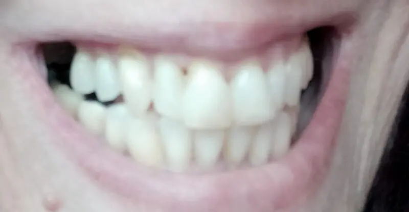 Zákazníčka — viditeľná medzera pri úsmeve