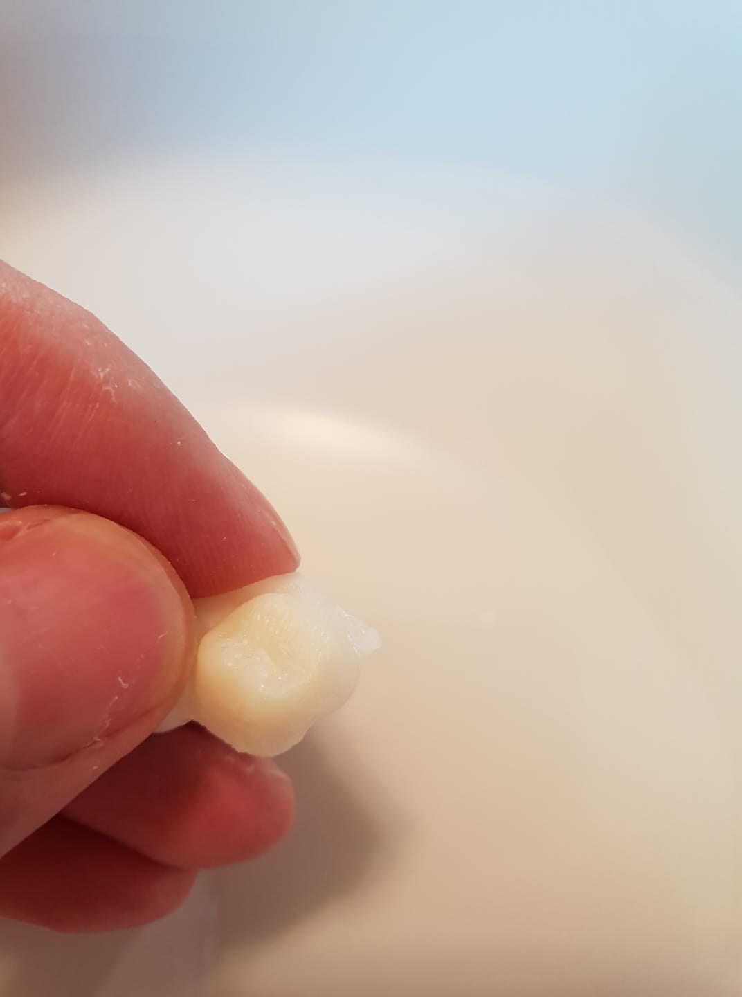Denticor a môj výskum na začiatku: prvý prototyp umelého zubu, super výsledok, už len vymyslieť spôsob uchytenia. Teda to najdôležitejšie.