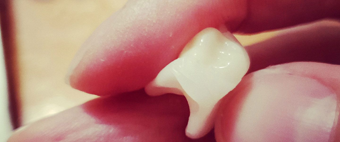 Predstavujem Vám novinku, zubné náhrady Denticor. Na obrázku vidíte novú krásnu stoličku. S Denticorom môžete nahradiť predné, bočné a zadné zuby, pričom každý nový zub bude takého tvaru, aký potrebujete.
