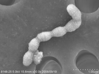  Streptococcus mutans